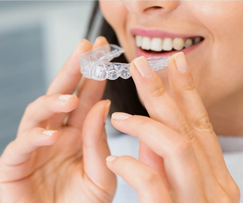 Close up of a young female's mouth. The lady is placing her Invisalign aligners into her mouth. 